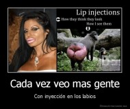 Cada vez veo mas gente - Con inyección en los labios